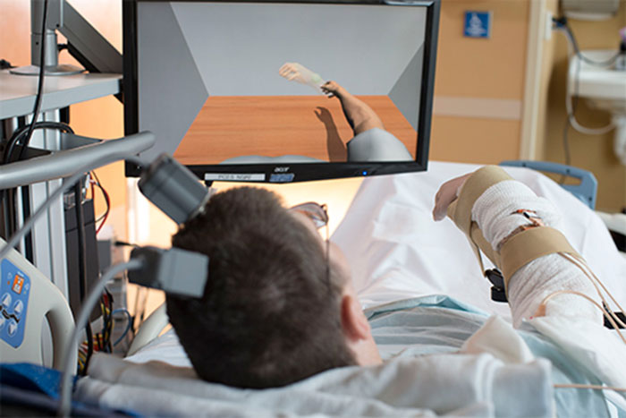 Muscle Injury Case Study
