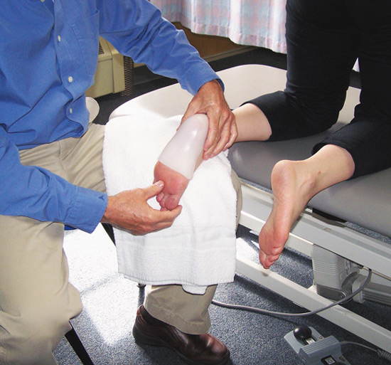 Figure 1. A temporary thermoplastic custom foot orthosis was casted in a plantar flexed and inverted position.